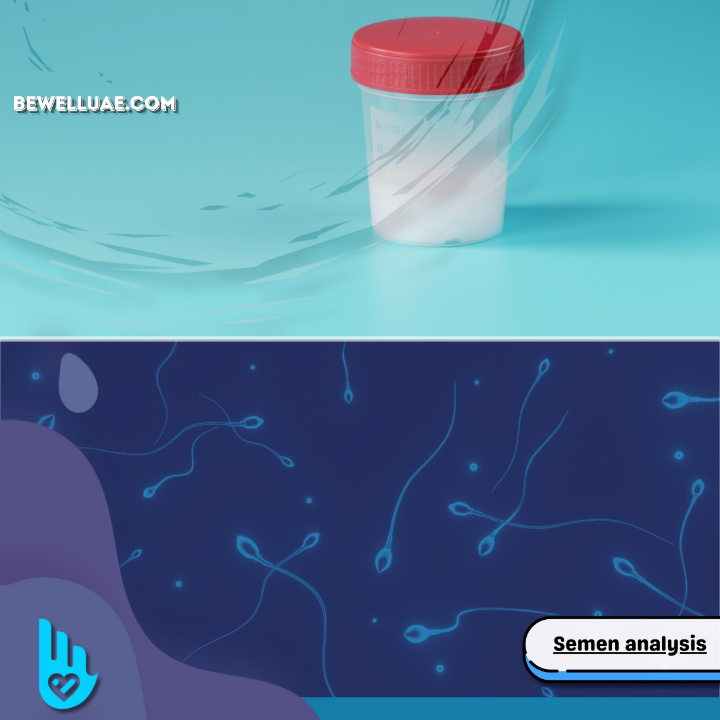 Semen analysis